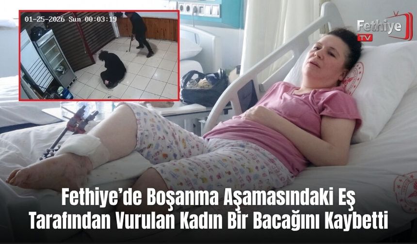 Fethiye’de Boşanma Aşamasındaki Eş Tarafından Vurulan Kadın Bir Bacağını Kaybetti